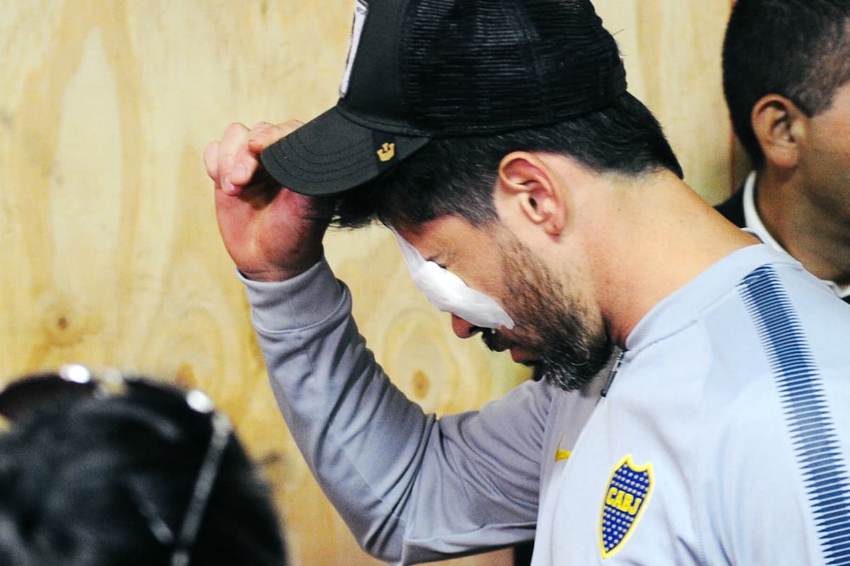 Pérez, agredido el sábado en el Monumental