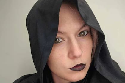 Phoenix Nightingale fue apodada en redes sociales como "la chica vampiro" por su extraña enfermedad que conmocionó a todo Reino Unido
