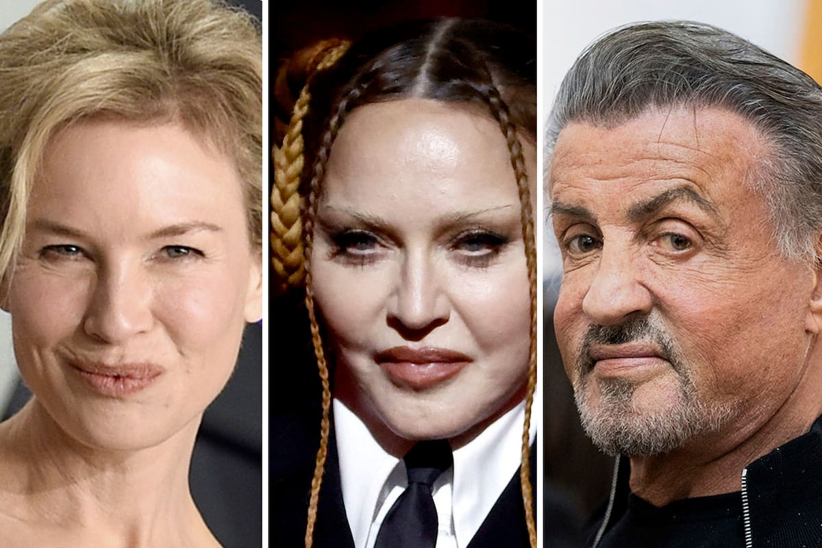 Pillow face: Renée Zellweger, Madonna, Sylvester Stallone, Kylie Jenner y Nicole Kidman son solo algunos de los nombres de celebridades que se han convertido en promotores de la industria de la belleza y han ayudado a impulsar la necesidad de procedimientos estéticos