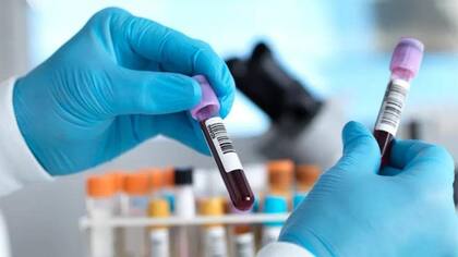 Pocos análisis médicos son 100% precisos