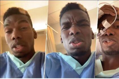 Pogba habló bajo los efectos de la anestesia y causó furor en las redes