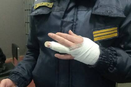 Policía lesionada en Villa María