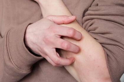 Por qué nos causan rechazo las personas que se rascan