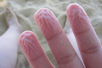 ¿Por qué se arruga la piel en el agua?