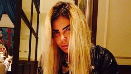 Preocupación por el estado de salud de Raquel Mancini