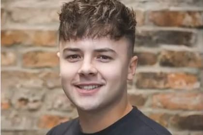 Preocupado por una incipiente calvicie, un joven inglés buscó un lugar barato para hacerse la intervención y terminó sufriendo consecuencias para nada agradables