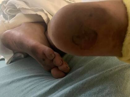 Presenta distintas heridas en su cuerpo y un traumatismo en su cabeza