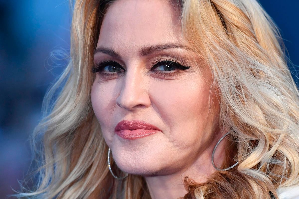 Problemas de ligamentos en las piernas de la reina del pop dejan en suspenso sus conciertos en Boston