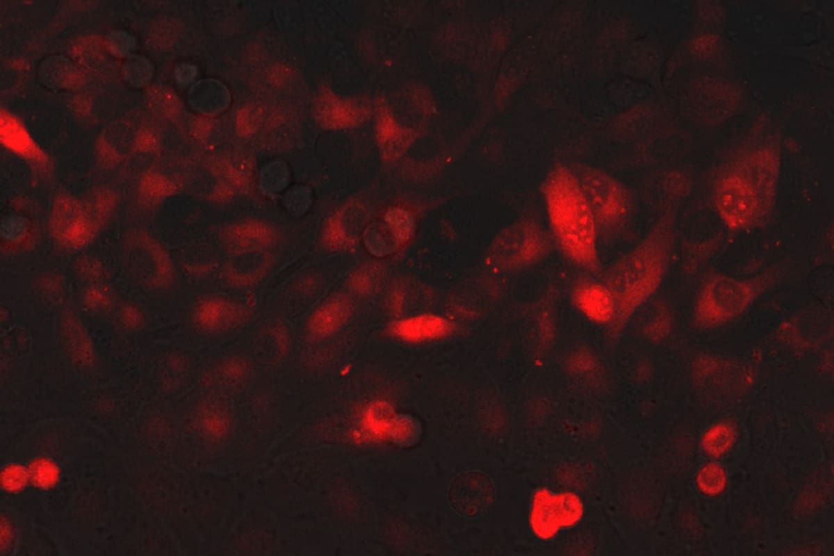 Proteína de cápside en células vivas