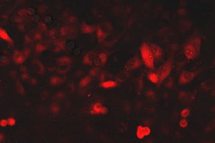 Proteína de cápside en células vivas