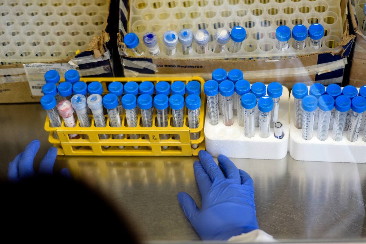 Prueban un tratamiento experimental