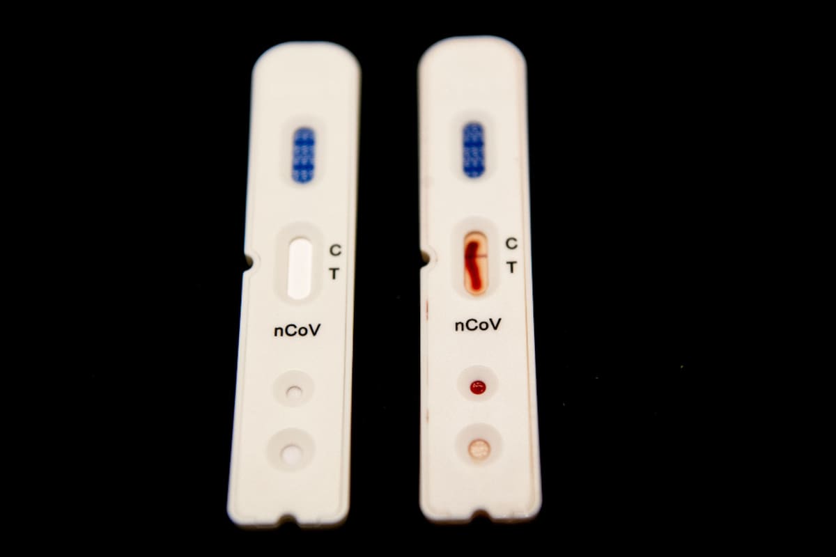 Pruebas rápidas para detectar la Covid-19 desarrolladas por la compañía holandesa Sensitest