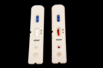 Pruebas rápidas para detectar la Covid-19 desarrolladas por la compañía holandesa Sensitest