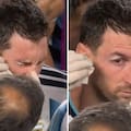 Qué le pasó en el ojo a Messi frente a Suiza: codazo y atención médica