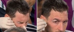 Qué le pasó en el ojo a Messi frente a Suiza: codazo y atención médica