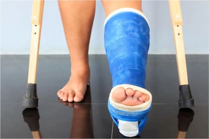 Quebrarse un hueso implica varias semanas o meses de reposo