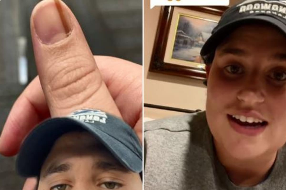 Quedó horrorizada al conocer la verdad detrás de una marca que apareció en su uña