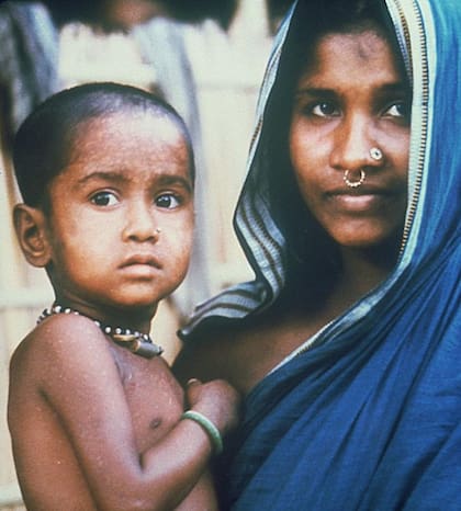 Rahima Banu, de 3 años, fue el último caso que se reportó de la variante Variola major de la viruela -la más contagiosa- en 1975 en Bangladesh.