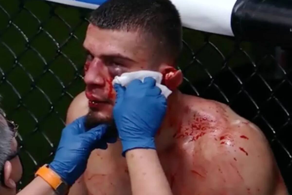 Ramiz Brahimaj, sufrió el desprendimiento de parte de su oreja en pleno combate