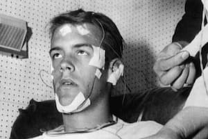 Randy Gardner estuvo 11 días y 25 minutos sin dormir, y batió el récord de mantenerse despierto