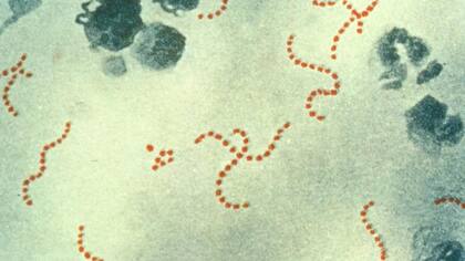 Reign tenía la bacteria estreptococo A, un microorganismo aerobio grampositivo que causan muchas enfermedades