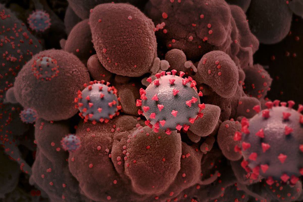Representación del virus SARS-CoV-2, causante del Covid-19