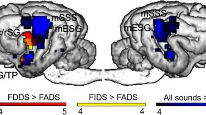 Respuestas del cerebro del perro a estímulos auditivos.
Foto: Página oficial: Springer Nature / En 'Dog brains are sensitive to infant- and dog-directed prosody'