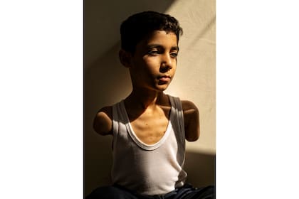 Retrato de un niño palestino que perdió ambos brazos es la Foto del Año de World Press Photo