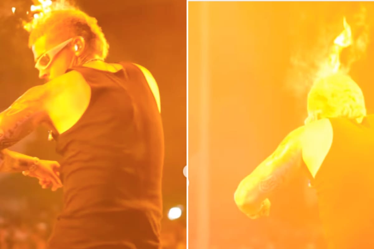 Reykon sufrió grave accidente durante un concierto y terminó prendido en llamas