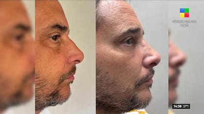 Rodrigo Lussich mostró su antes y después en vivo
