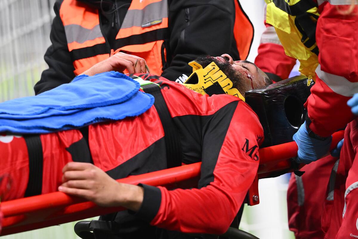 Ruben Loftus-Cheek, de Milan, cuando lo retiraron del estadio tras el choque con Corvi. (Photo by Giuseppe Bellini/Getty Images)