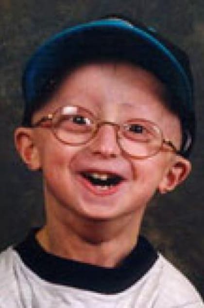 Sam Berns fue diagnosticado a los 22 meses
Foto: Progeria Research Foundation