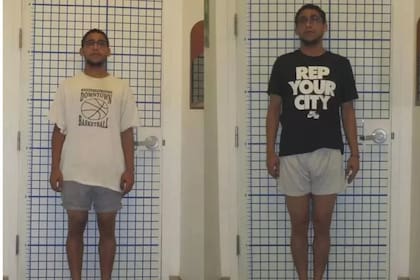 Sam, el hombre de la imagen, se sometió a una operación que le ayudó a ganar unos centímetros