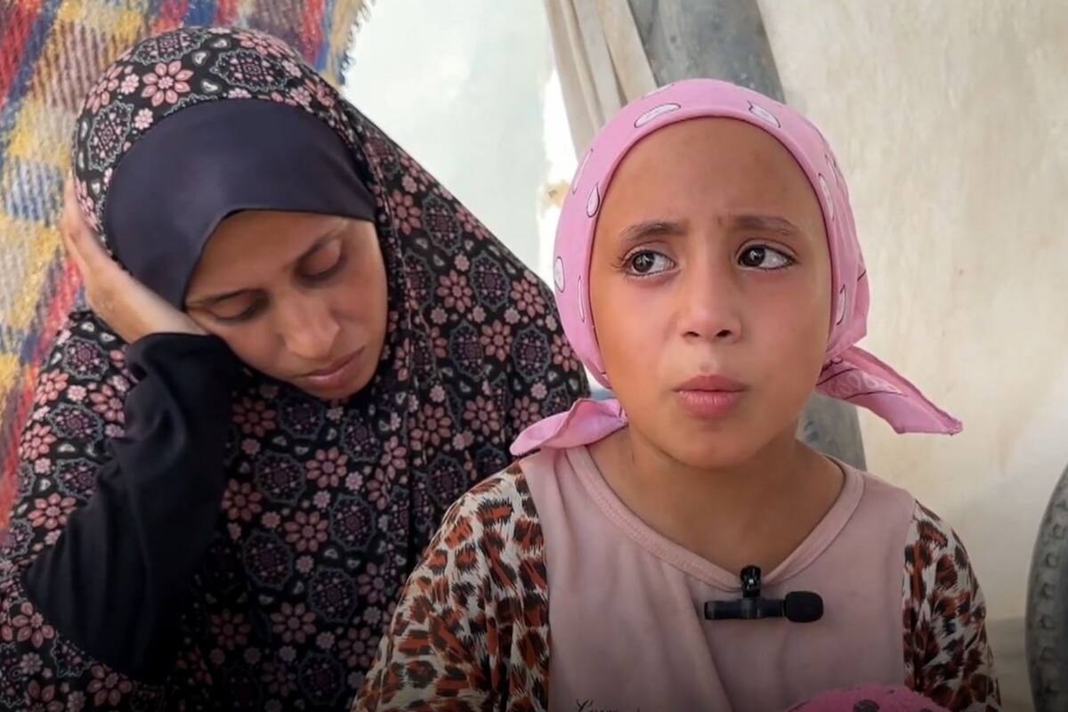 Sama es una niña de ocho años que vive en Franja de Gaza; el estrés sufrido por el conflicto bélico hizo que perdiera gran parte de su cabello (captura de video de NBC News).