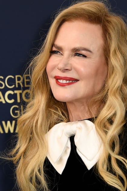 Hay varios famosos que expresaron su arrepentimiento por haberse sometido a tratamientos estéticos, una de ellas es Nicole Kidman