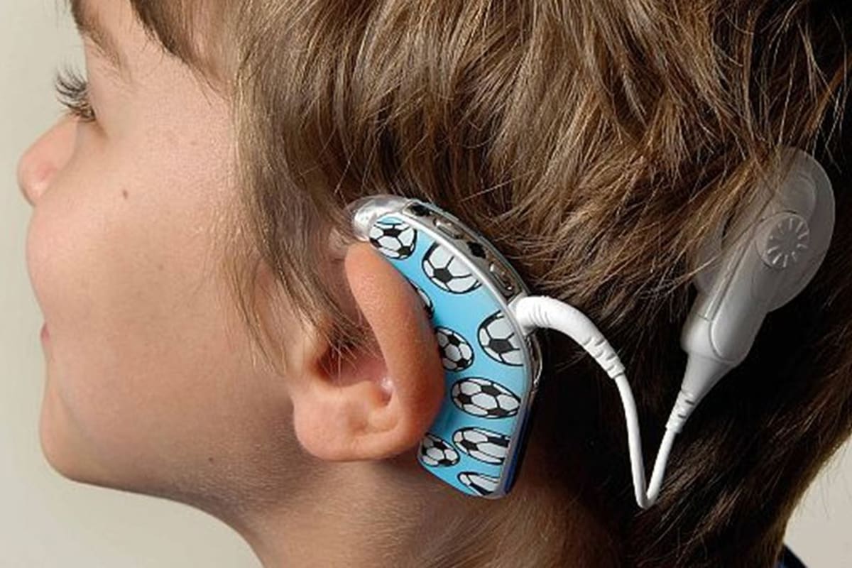 Santiago padece sordera bilateral profunda y perdió el implante coclear, que es muy costoso