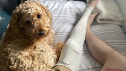 Scott pasó meses recibiendo terapia para recuperarse