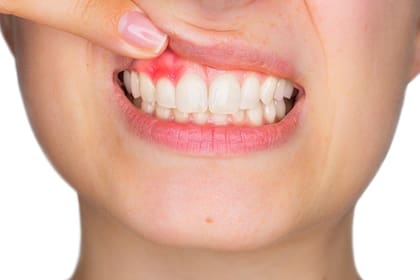 Se está empezando a ver que hay un estrecho vínculo entre la salud bucal y algunas de las enfermedades más apremiantes del mundo