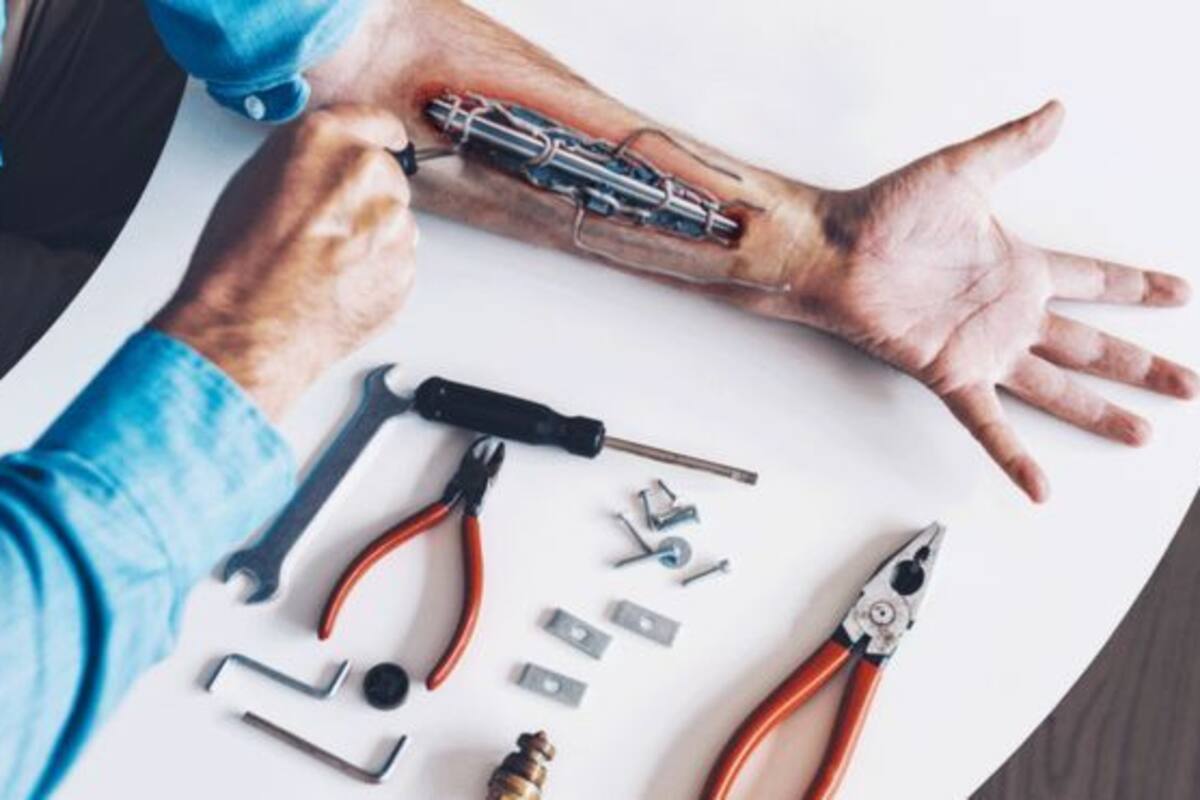 Se estima que unas 10.000 personas tienen ya chips bajo su piel, aunque lo de esta foto es un montaje