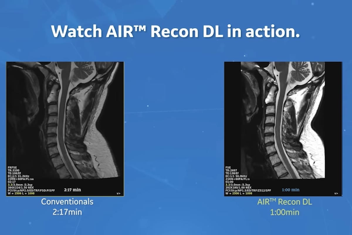 Se lograron mejoras significativas en la generación de imágenes de alta calidad, fundamentales en el caso de la IMR, donde la información detallada es clave