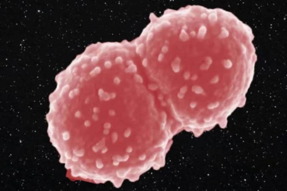 Se trata de la Deinococcus radiocurans, un microorganismo que soportó el vacío, la falta de gravedad, las fluctuaciones de temperatura y las radiaciones ultravioleta del espacio y se mantuvo con vida, aunque desarrolló algunas modificaciones que los científicos están analizando