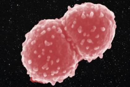 Se trata de la Deinococcus radiocurans, un microorganismo que soportó el vacío, la falta de gravedad, las fluctuaciones de temperatura y las radiaciones ultravioleta del espacio y se mantuvo con vida, aunque desarrolló algunas modificaciones que los científicos están analizando