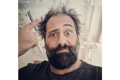 "Este diente me lo rompió Suar", confiesa con humor Sebastián Mogordoy