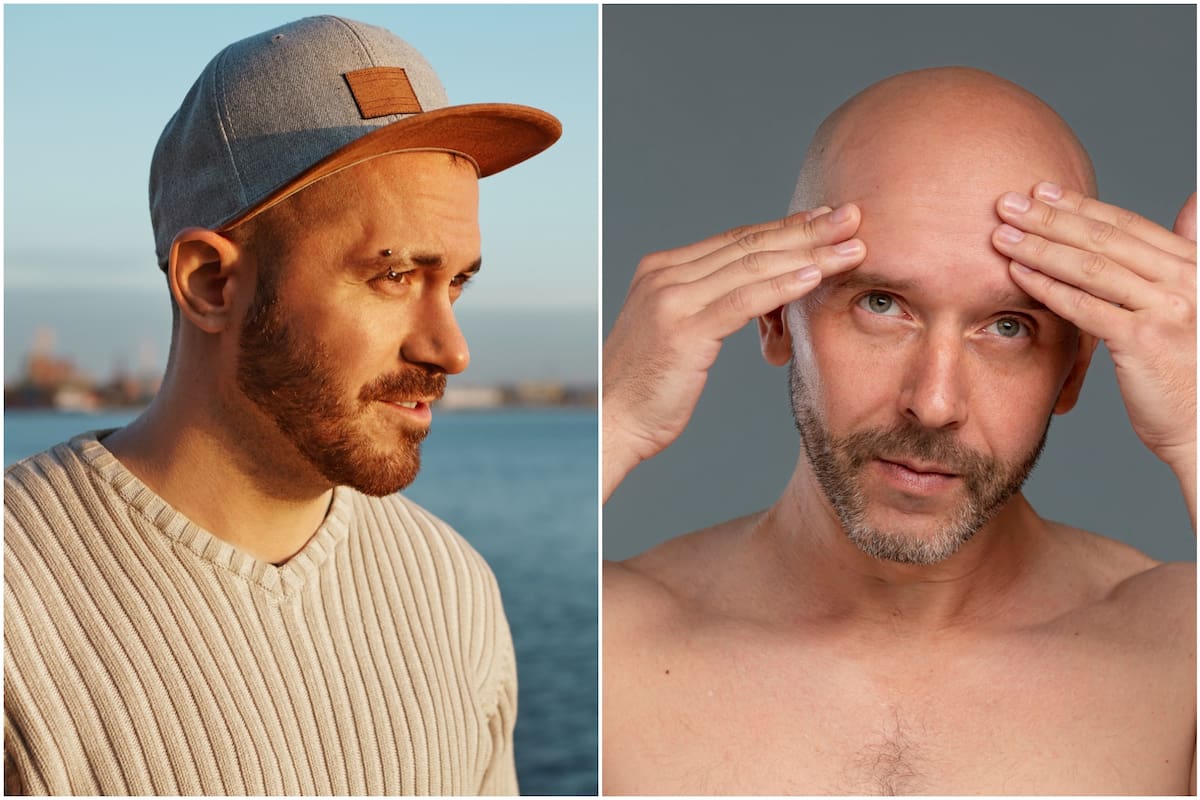 Según la ciencia, no existe una investigación que vincule directamente el uso de gorras con un mayor riesgo de pérdida de cabello