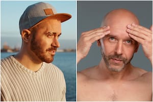 Según la ciencia, no existe una investigación que vincule directamente el uso de gorras con un mayor riesgo de pérdida de cabello
