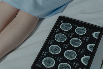 Según los estudios científicos, el cerebro seguiría con vida al menos unos segundos después de morir