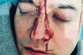 Leo García denunció que fue brutalmente golpeado “por ser gay”