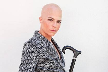 Después de una larga, intensa y dolorosa lucha contra la esclerosis múltiple, Selma Blair informó en 2021 que se encontraba en remisión