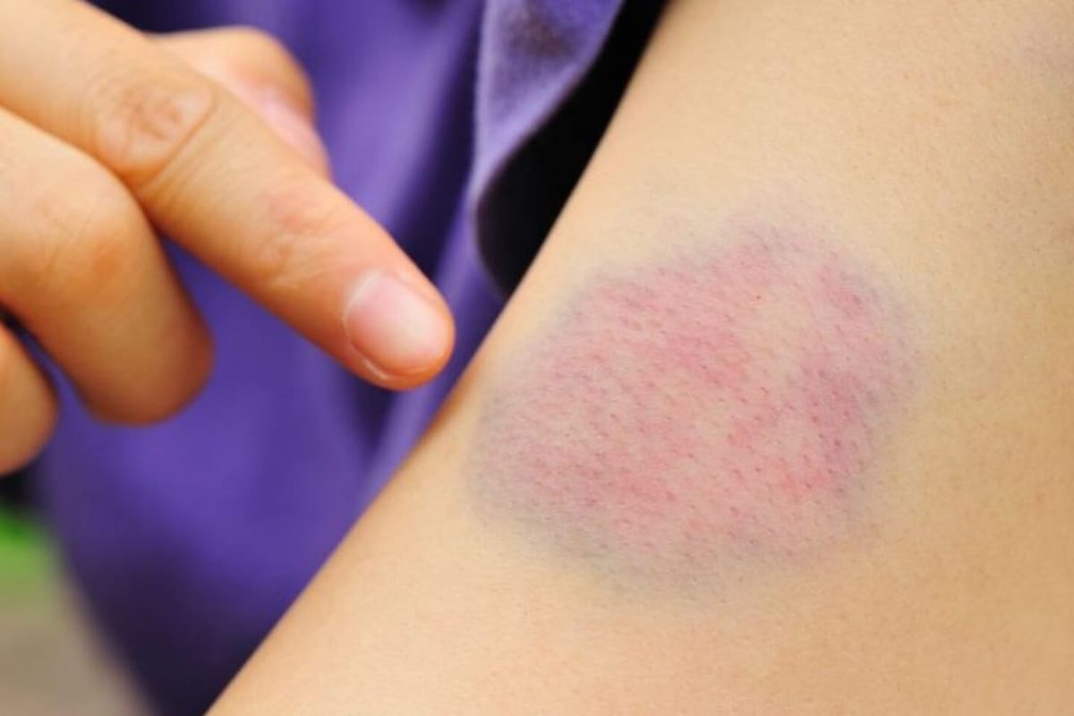 Señales de deficiencias nutricionales.