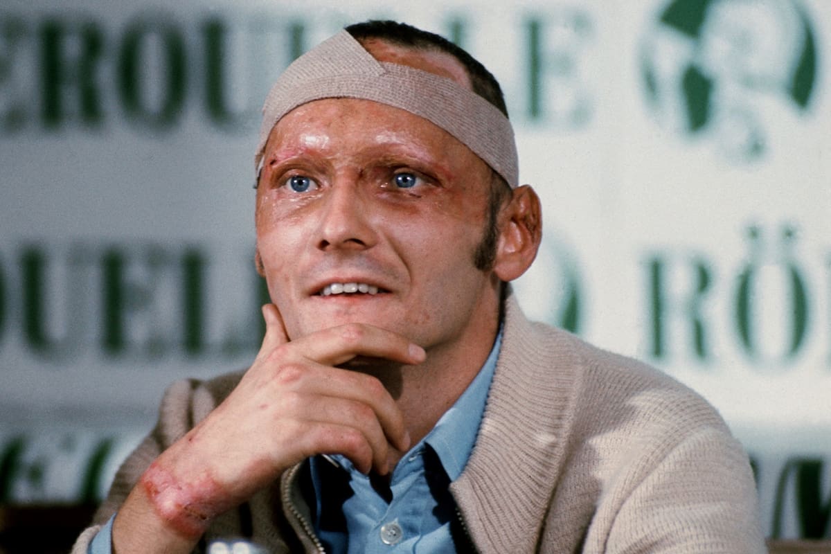 Septiembre de 1976: Lauda atiende a la prensa luego de su terrible accidente en Alemania